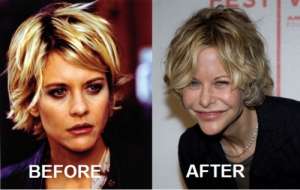 Worst Plastic Surgery Fails 10