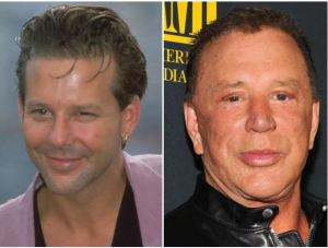 Plastic Surgery Fails 9